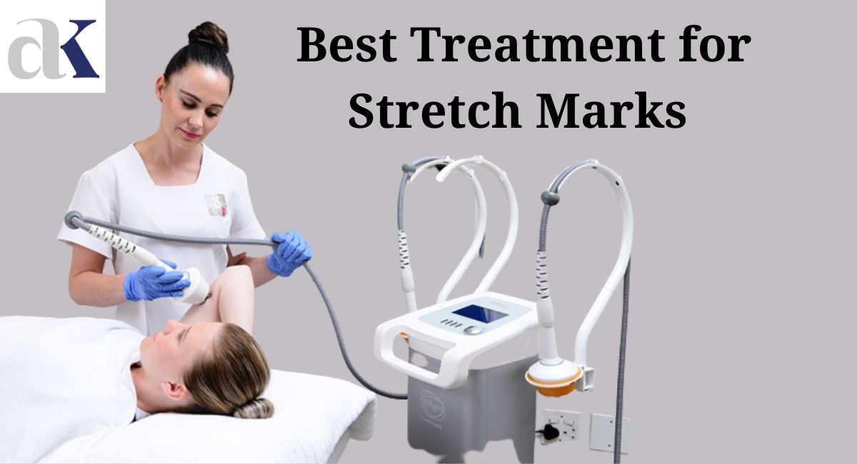 Transform Your Skin: Here is the Best Treatment for Stretch Marks By Dr. Atul Kathed