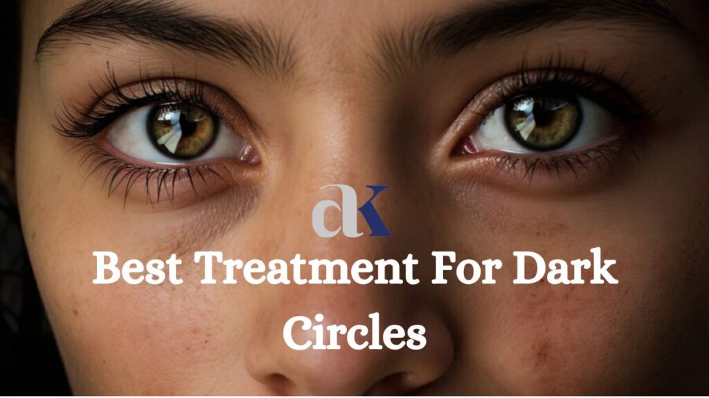 Dr. Atul Kathed's Expert Insights: Best Treatment For Dark Circles