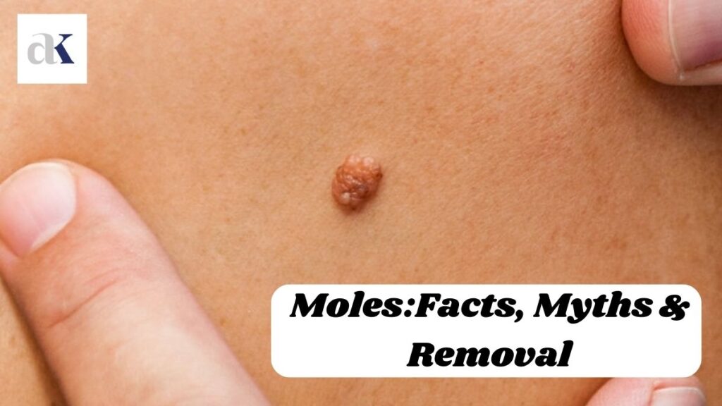 Moles