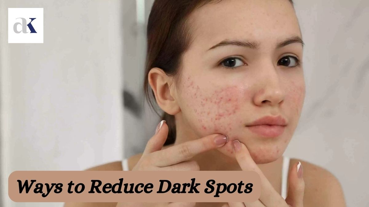 5 Simple Ways to Reduce Dark Spots by Dr. Atul Kathed